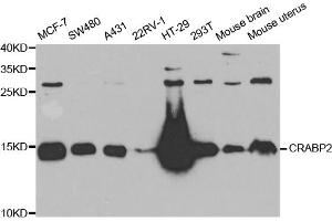 Western blot analysis of extracts of various cell lines, using CRABP2 antibody. (CRABP2 antibody)