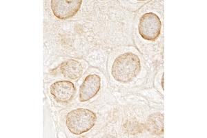 anti-Torsin A Interacting Protein 1 (TOR1AIP1) (AA 275-325) antibody