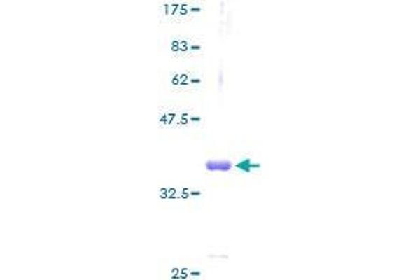 GAL Protein (AA 1-123) (GST tag)