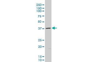 AKR1B10 polyclonal antibody (A01), Lot # UOP11060207QCS1 Western Blot analysis of AKR1B10 expression in K-562 . (AKR1B10 antibody  (AA 76-143))