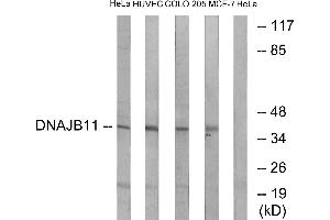 Immunohistochemistry analysis of paraffin-embedded human heart tissue using DNAJB11 antibody. (DNAJB11 antibody)
