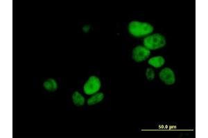 Immunofluorescence of monoclonal antibody to UHRF1 on MCF-7 cell. (UHRF1 antibody  (AA 694-793))