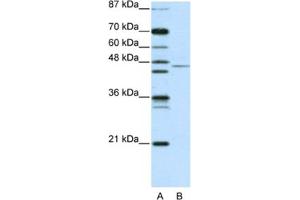 Western Blotting (WB) image for anti-Tripartite Motif Containing 14 (TRIM14) antibody (ABIN2461040) (TRIM14 antibody)