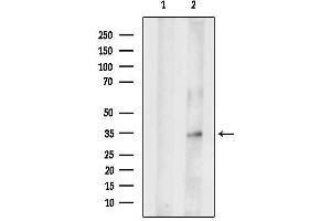 Western blot analysis of lysates from Myeloma cells, using GIPC2 Antibody.