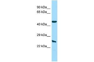 Host: Rabbit Target Name: NIPAL4 Sample Type: Hela Whole Cell lysates Antibody Dilution: 1. (NIPAL4 antibody  (N-Term))