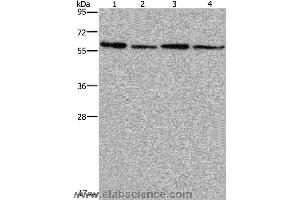 Western blot analysis of Mouse kidney, liver, heart and brain tissue, using ART4 Polyclonal Antibody at dilution of 1:667