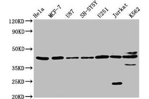 Western Blot Positive WB detected in: Hela whole cell lysate, MCF-7 whole cell lysate, U87 whole cell lysate, SH-SY5Y whole cell lysate, U251 whole cell lysate, Jurkat whole cell lysate, K562 whole cell lysate All lanes: NPY2R antibody at 3.
