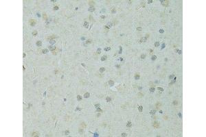 Immunohistochemistry of paraffin-embedded Rat brain using TRIM28 Polyclonal Antibody at dilution of 1:100 (40x lens). (KAP1 antibody)