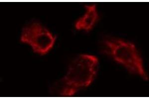 ABIN6275482 staining Hela cells by IF/ICC. (RGS7 antibody  (Internal Region))