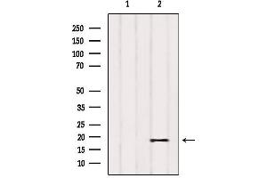 Western blot analysis of extracts from Cos-7, using PIGP Antibody.