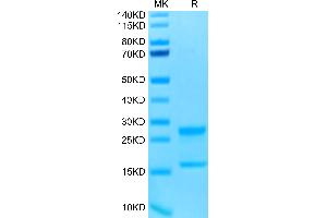 Biotinylated Human IL-17A&F on Tris-Bis PAGE under reduced conditions. (IL-17A/F Protein (His-Avi Tag,Biotin))