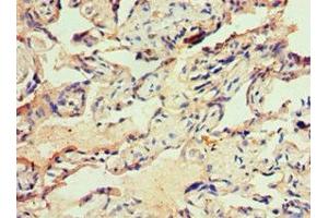 Immunohistochemistry of paraffin-embedded human placenta tissue using ABIN7156485 at dilution of 1:100