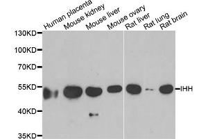 Western blot analysis of extracts of various cell lines, using IHH antibody (ABIN5973985) at 1/1000 dilution. (Indian Hedgehog antibody)