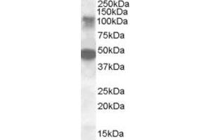Image no. 2 for anti-serine/threonine Kinase 11 Interacting Protein (STK11IP) (AA 732-746) antibody (ABIN490511) (STK11IP antibody  (AA 732-746))