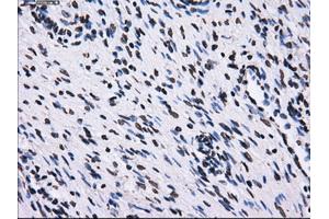 Immunohistochemical staining of paraffin-embedded colon tissue using anti-RPA2 mouse monoclonal antibody. (RPA2 antibody)