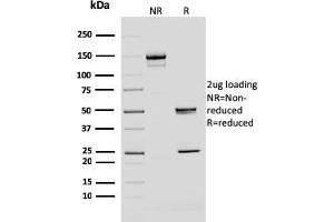 SDS-PAGE Analysis Purified BMI1 Mouse Monoclonal Antibody (BMI1/2690). (BMI1 antibody  (AA 142-326))