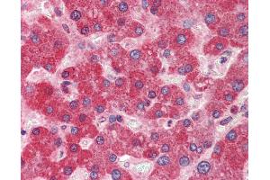 Immunohistochemistry (IHC) image for anti-DiGeorge Syndrome Critical Region Gene 8 (DGCR8) (N-Term) antibody (ABIN2776557) (DGCR8 antibody  (N-Term))