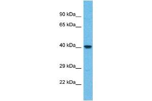 Western Blotting (WB) image for anti-WD Repeat Domain 86 (WDR86) (N-Term) antibody (ABIN2791988) (WDR86 antibody  (N-Term))
