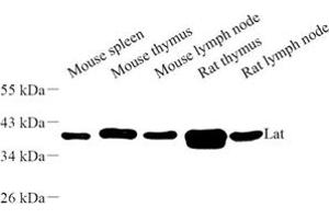 Western blot analysis of Lat (ABIN7074502) at dilution of 1: 500 (LAT antibody)