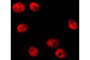 ABIN6275665 staining HepG2 by IF/ICC. (Ube2t antibody  (Internal Region))