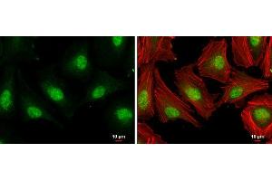 ICC/IF Image E2F1 antibody [N1N3] detects E2F1 protein at nucleus by immunofluorescent analysis. (E2F1 antibody)