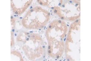 IHC-P analysis of Human Tissue, with DAB staining. (RAC1 antibody  (AA 1-189))