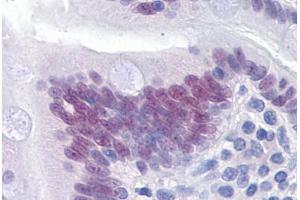 Human Small intestine: Formalin-Fixed, Paraffin-Embedded (FFPE) (CDX2 antibody  (AA 1-314))