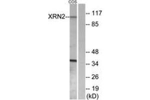 Western Blotting (WB) image for anti-5'-3' Exoribonuclease 2 (XRN2) (AA 81-130) antibody (ABIN2889753) (XRN2 antibody  (AA 81-130))