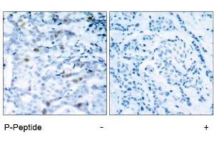 Image no. 1 for anti-Cyclin-Dependent Kinase 1 (CDK1) (pThr161) antibody (ABIN196847) (CDK1 antibody  (pThr161))
