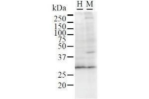 Detection of GATAD1 by Western Blot. (GATAD1 antibody)