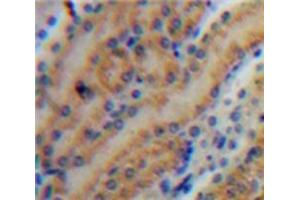Used in DAB staining on fromalin fixed paraffin-embedded Kidney tissue (MMP7 antibody  (AA 1-267))