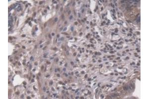 Detection of PRKDC in Mouse Uterus Tissue using Polyclonal Antibody to Protein Kinase, DNA Activated, Catalytic Polypeptide (PRKDC) (PRKDC antibody  (AA 3899-4128))