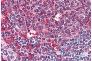 Human Tonsil (formalin-fixed, paraffin-embedded) stained with SYK antibody ABIN334248 at 10 ug/ml followed by biotinylated anti-mouse IgG secondary antibody ABIN481714, alkaline phosphatase-streptavidin and chromogen. (SYK antibody  (AA 5-360))