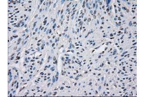 Immunohistochemical staining of paraffin-embedded endometrium tissue using anti-BUB1Bmouse monoclonal antibody. (BUB1B antibody)