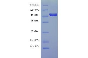 SDS-PAGE (SDS) image for FOS-Like Antigen 2 (FOSL2) (AA 1-326), (full length) protein (His-SUMO Tag) (ABIN4975723) (FOSL2 Protein (AA 1-326, full length) (His-SUMO Tag))