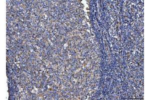 IHC analysis of CD14 using anti-CD14 antibody (ABIN7600531). (CD14 antibody  (AA 20-259))
