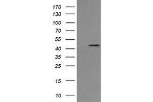 Image no. 3 for anti-Mitogen-Activated Protein Kinase Kinase 1 (MAP2K1) antibody (ABIN1499395) (MEK1 antibody)