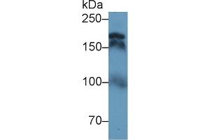 Western Blot; Sample: Human Serum; Primary Ab: 1µg/ml Rabbit Anti-Human TOP2 Antibody Second Ab: 0. (TOP2 antibody  (AA 923-1148))