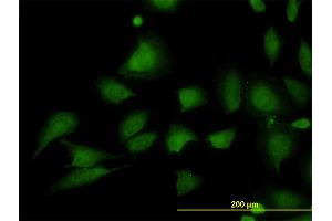 Immunofluorescence of monoclonal antibody to STIM1 on HeLa cell. (STIM1 antibody  (AA 24-685))