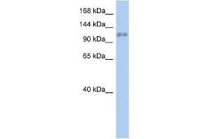WB Suggested Anti-ZNF217 Antibody Titration:  0.