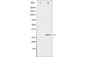 Western blot analysis of HSP27 phosphorylation expression in Ca2+ treated HeLa whole cell lysates,The lane on the left is treated with the antigen-specific peptide. (HSP27 antibody  (pSer82))