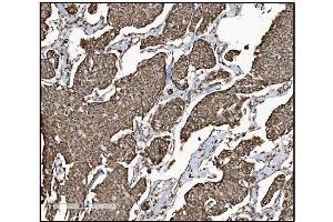 IHC analysis of FABP-1/GOT2 using anti-FABP-1/GOT2 antibody (ABIN7601426). (GOT2 antibody  (AA 35-430))
