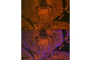 Immunofluorescence analysis of rat kidney using  Rabbit pAb (ABIN6131167, ABIN6136429, ABIN6136430 and ABIN6216480) at dilution of 1:100 (40x lens).