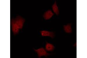 ABIN6267610 staining NIH-3T3 by IF/ICC. (FAK antibody  (pSer843))