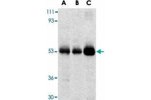 Western blot analysis of TRIM5 expression in human stomach (A), thymus (B), and uterus (C) cell lysate with TRIM5 alpha polyclonal antibody  at 2 ug /mL .