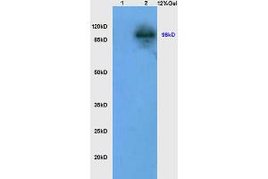 SDS-PAGE (SDS) image for anti-Lon Peptidase 1, Mitochondrial (LONP1) (AA 361-460) antibody (ABIN705806)