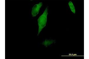 Immunofluorescence of purified MaxPab antibody to CC2D1A on HeLa cell. (CC2D1A antibody  (AA 1-951))
