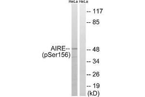 Western blot analysis of extracts from HeLa cells treated with Hu using AIRE (Phospho-Ser156) Antibody. (AIRE antibody  (pSer156))