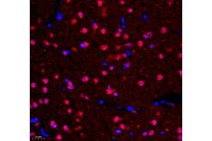 Immunofluorescence of paraffin embedded rat corpus striatum using NCBP2 (ABIN7074870) at dilution of 1: 650 (400x lens) (NCBP2 antibody)