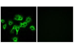 Immunofluorescence analysis of MCF-7 cells, using CDON antibody. (CDON antibody  (Internal Region))